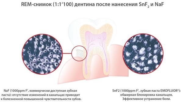 Ополіскувач для порожнини рота Dr. Wild Emofluor Daily Care, 400 мл