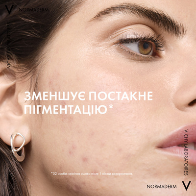 Гель-сироватка для вмивання Vichy Normaderm очищувальний з ефектом пілінгу для проблемної шкіри обличчя та тіла, 125 мл