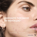 Гель-сироватка для вмивання Vichy Normaderm очищувальний з ефектом пілінгу для проблемної шкіри обличчя та тіла, 125 мл