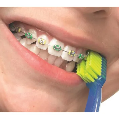Зубна щітка Curaprox Ortho Ultra Soft ортодонтична із заглибленням d 0,10 мм, 1 шт