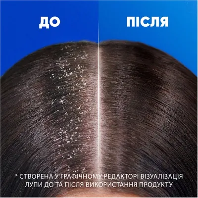 Шампунь і бальзам-ополіскувач Head & Shoulders 2-in-1 Citrus Fresh Цитрусова свіжість проти лупи, 330 мл