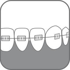 Зубная щетка Paro Swiss ortho brush child детская ортодонтическая