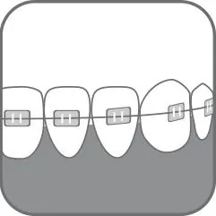 Зубна щітка Paro Swiss ortho brush child дитяча ортодонтична