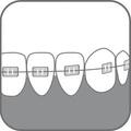 Зубная щетка Paro Swiss ortho brush child детская ортодонтическая