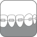 Зубна щітка Paro Swiss ortho brush child дитяча ортодонтична