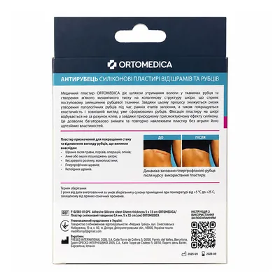 Пластир силіконовий Ortomedica F-02565-01 OPC Антирубець від шрамів та рубців товщина 0,4 мм, 5 x 7,5 см, 4 штуки