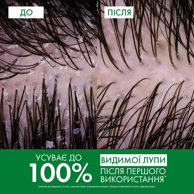 Шампунь Vichy Dercos посиленої дії проти лупи для сухого волосся та подразненої шкіри голови, 200 мл