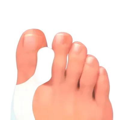 Протектор на кісточку Pedag Hallux Toe Spreader 277 з міжпальцевою перегородкою, гелевий