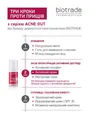 Крем для обличчя Biotrade Acne Out активний для проблемної шкіри з вуграми та комедонами, 30 мл