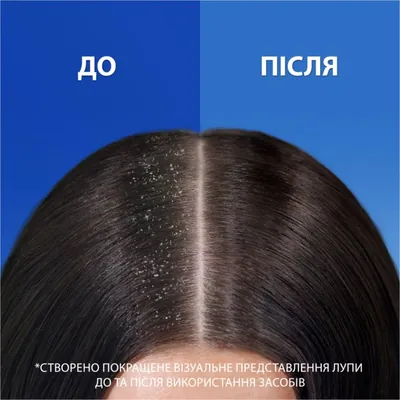 Шампунь і бальзам-ополіскувач Head & Shoulders 2-in-1 Citrus Fresh Цитрусова свіжість проти лупи, 360 мл