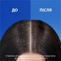 Шампунь і бальзам-ополіскувач Head & Shoulders 2-in-1 Classic Clean Основний догляд проти лупи, 360 мл
