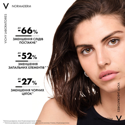 Сыворотка-пилинг для лица Vichy Normaderm для коррекции недостатков жирной и проблемной кожи лица, 30 мл