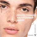 Сыворотка-пилинг для лица Vichy Normaderm для коррекции недостатков жирной и проблемной кожи лица, 30 мл