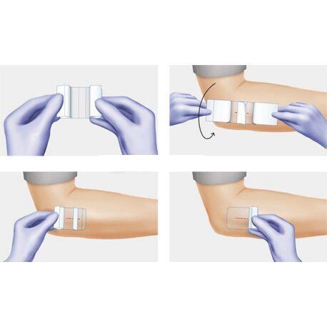 Повязка пленочная Hydrofilm прозрачная, 10 см х 15 см, 10 штук