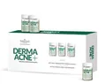 Концентрат для обличчя Farmona DermaAcne+ нормалізуючий, 5 мл №5